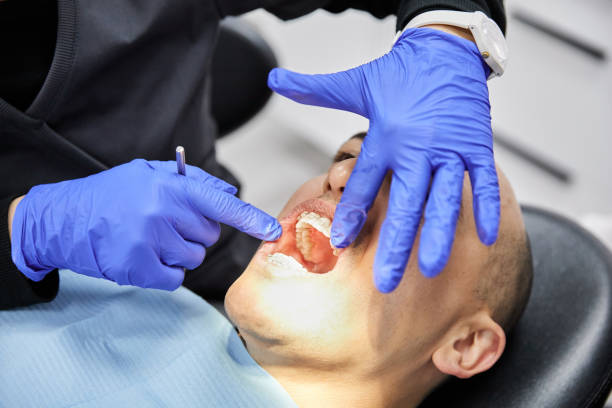 Best Emergency Tooth Extraction in Cedar Hills, OR